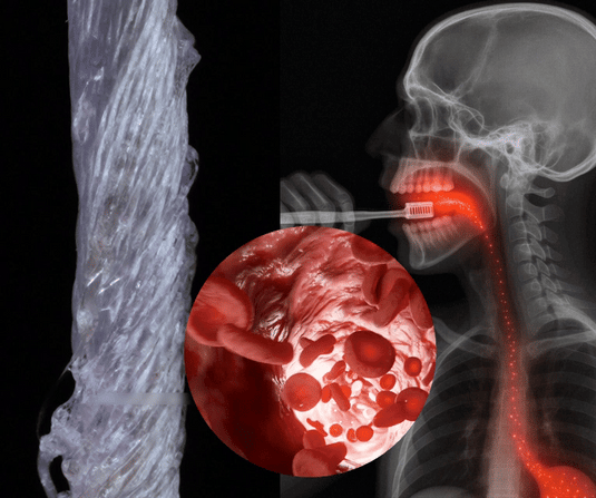 Microplastic particles absorbing through gum tissue